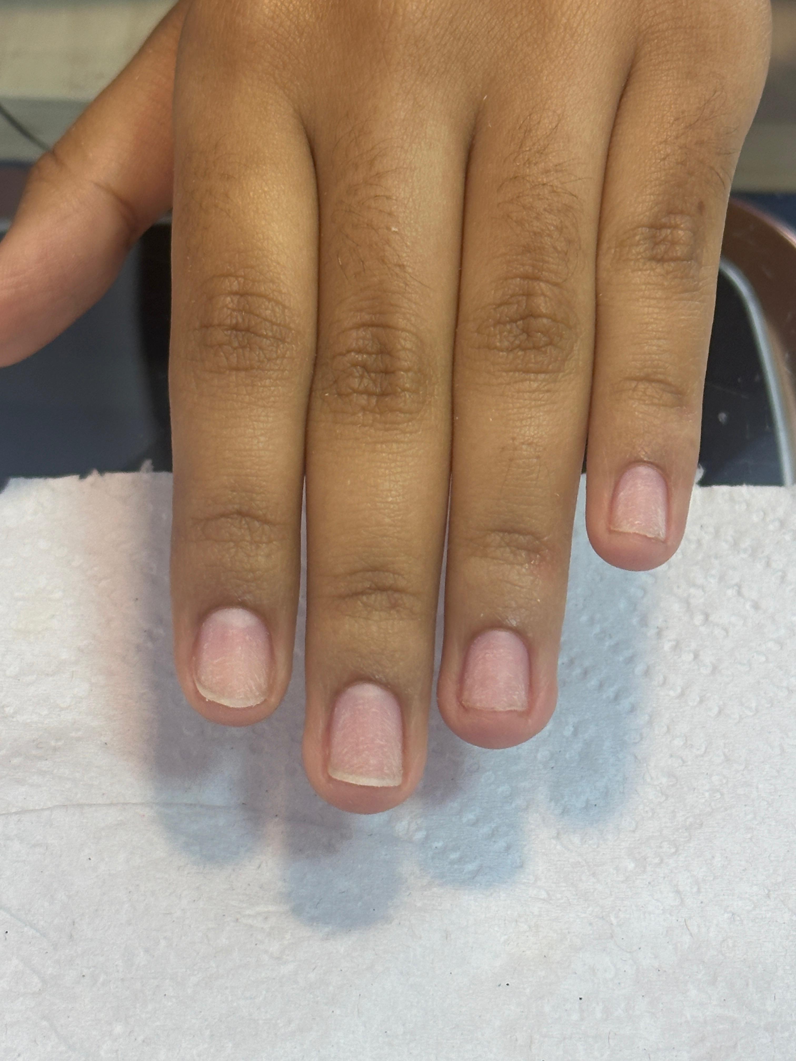 Uñas antes